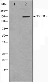 PDGFRA / PDGFR Alpha Antibody - Western blot analysis on 293 cell lysates using PDGFRalpha antibody. The lane on the left is treated with the antigen-specific peptide.