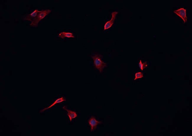 PDGFRA / PDGFR Alpha Antibody - Staining CACO-2 cells by IF/ICC. The samples were fixed with PFA and permeabilized in 0.1% Triton X-100, then blocked in 10% serum for 45 min at 25°C. The primary antibody was diluted at 1:200 and incubated with the sample for 1 hour at 37°C. An Alexa Fluor 594 conjugated goat anti-rabbit IgG (H+L) antibody, diluted at 1/600, was used as secondary antibody.