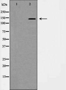 PDGFRA / PDGFR Alpha Antibody - Western blot analysis of PDGFR a expression in HepG2 cells. The lane on the left is treated with the antigen-specific peptide.