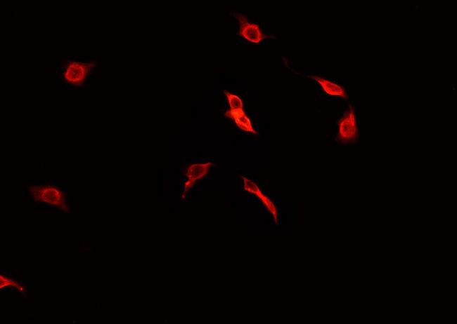 PDGFRA / PDGFR Alpha Antibody - Staining CACO-2 cells by IF/ICC. The samples were fixed with PFA and permeabilized in 0.1% Triton X-100, then blocked in 10% serum for 45 min at 25°C. The primary antibody was diluted at 1:200 and incubated with the sample for 1 hour at 37°C. An Alexa Fluor 594 conjugated goat anti-rabbit IgG (H+L) antibody, diluted at 1/600, was used as secondary antibody.