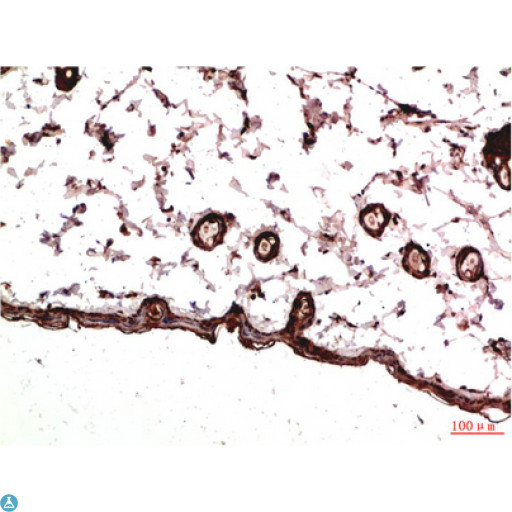 PDGFRA / PDGFR Alpha Antibody - Immunohistochemistry (IHC) analysis of paraffin-embedded Rat Skin Tissue using PDGFR a Mouse monoclonal antibody diluted at 1:200.