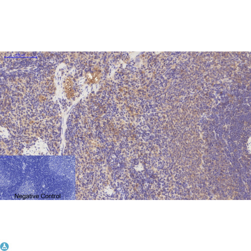 PDGFRA / PDGFR Alpha Antibody - Immunohistochemical analysis of rat spleen tissue. Anti-PDGFRalpha at 1:200 (4°C, overnight). Antigen retrieval - Sodium Citrate pH6 (>98°C, 20min). Secondary - 1:200 (room temp, 30min). Negative control - Secondary only