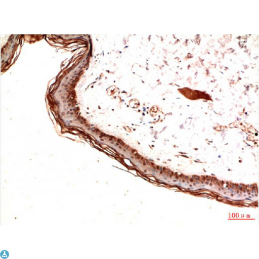 PDGFRA / PDGFR Alpha Antibody - Immunohistochemistry (IHC) analysis of paraffin-embedded Human Skin Tissue using PDGFR a Mouse monoclonal antibody diluted at 1:200.