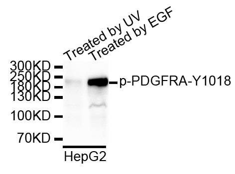 PDGFRA / PDGFR Alpha Antibody - Western blot analysis of extracts of HepG2 cells.