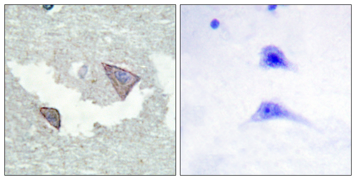 PDGFRA / PDGFR Alpha Antibody - Immunohistochemistry analysis of paraffin-embedded human brain, using PDGFR alpha (Phospho-Tyr754) Antibody. The picture on the right is blocked with the phospho peptide.
