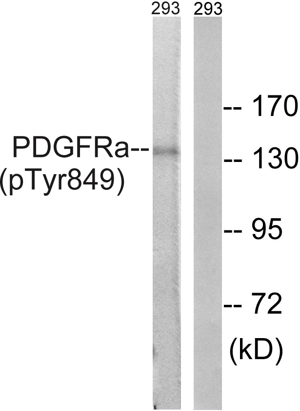 PDGFRA / PDGFR Alpha Antibody - Western blot analysis of lysates from 293 cells, using PDGFRa (Phospho-Tyr849) Antibody. The lane on the right is blocked with the phospho peptide.