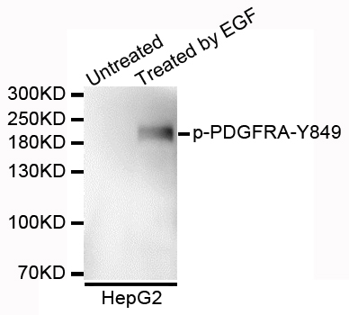 PDGFRA / PDGFR Alpha Antibody - Western blot analysis of extracts of HepG2 cells.