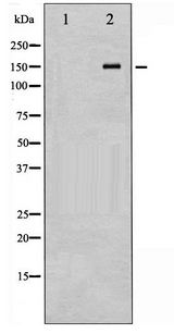 PDGFRA / PDGFR Alpha Antibody - Western blot of PDGFRa phosphorylation expression in 293 whole cell lysates,The lane on the left is treated with the antigen-specific peptide.