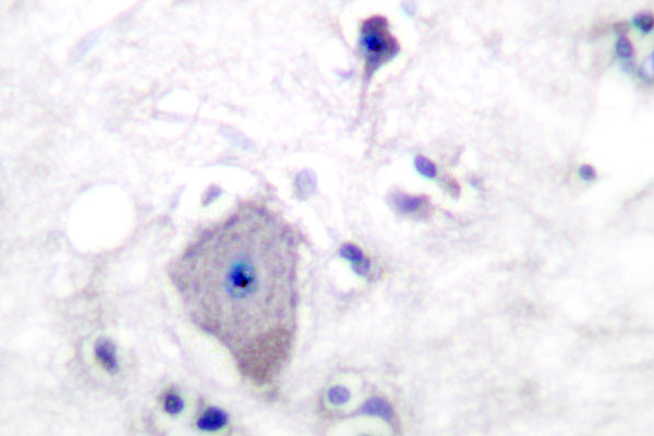 PDGFRA / PDGFR Alpha Antibody - IHC of PDGFR- (S1057) pAb in paraffin-embedded human brain tissue.