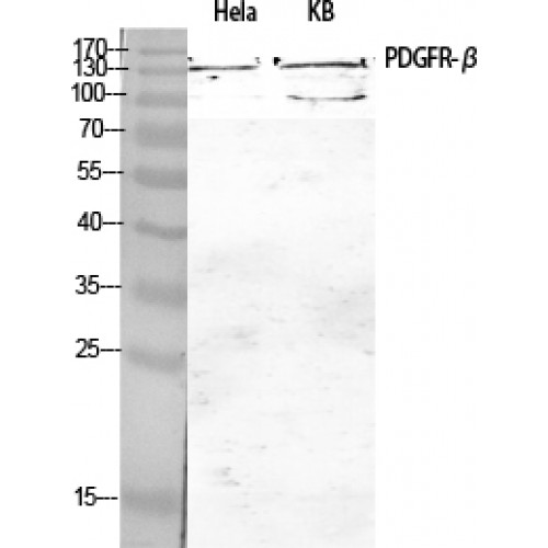 PDGFRB / PDGFR Beta Antibody - Western blot of PDGFR-beta antibody