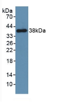 PDGFRB / PDGFR Beta Antibody - Western Blot; Sample: Recombinant PDGFRb, Mouse.