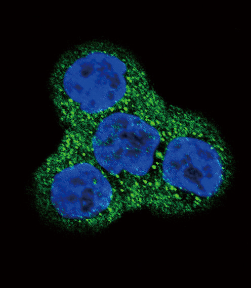 PDGFRB / PDGFR Beta Antibody - Confocal immunofluorescence of PDGFRB Antibody with WiDr cell followed by Alexa Fluor 488-conjugated goat anti-rabbit lgG (green). DAPI was used to stain the cell nuclear (blue).