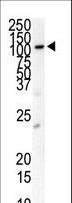 PDGFRB / PDGFR Beta Antibody - Western blot of anti-PDGFRB Antibody in cell line lysates (35 ug/lane). PDGFRB(arrow) was detected using the purified antibody).