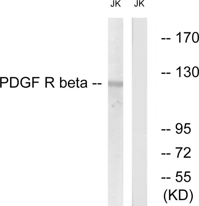 PDGFRB / PDGFR Beta Antibody - Western blot analysis of lysates from Jurkat cells, treated with TNF-a 20ng/ml 5', using PDGFR beta Antibody. The lane on the right is blocked with the synthesized peptide.