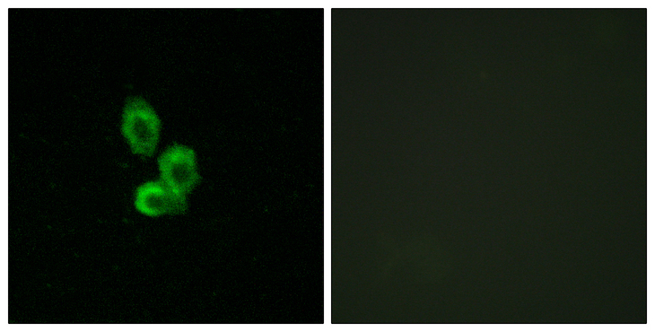 PDGFRB / PDGFR Beta Antibody - Immunofluorescence analysis of HepG2 cells, using PDGF Receptor beta Antibody. The picture on the right is blocked with the synthesized peptide.