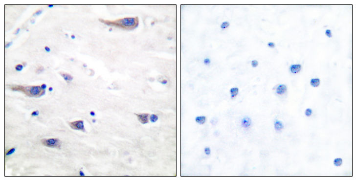 PDGFRB / PDGFR Beta Antibody - Immunohistochemistry analysis of paraffin-embedded human brain tissue, using PDGF Receptor beta Antibody. The picture on the right is blocked with the synthesized peptide.
