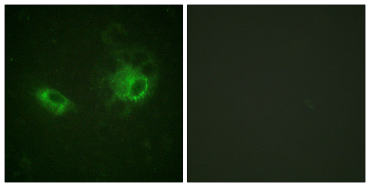 PDGFRB / PDGFR Beta Antibody - Immunofluorescence analysis of HeLa cells, using PDGFRB Antibody. The picture on the right is blocked with the synthesized peptide.