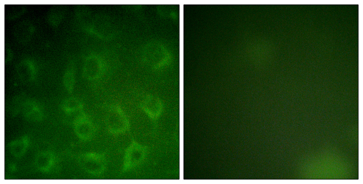 PDGFRB / PDGFR Beta Antibody - Immunofluorescence analysis of COS7 cells, using PDGFR beta Antibody. The picture on the right is blocked with the synthesized peptide.