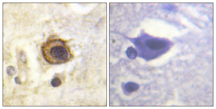 PDGFRB / PDGFR Beta Antibody - Immunohistochemistry analysis of paraffin-embedded human brain tissue, using PDGFR beta Antibody. The picture on the right is blocked with the synthesized peptide.