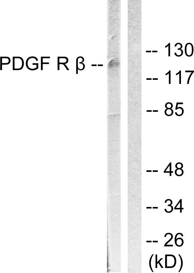 PDGFRB / PDGFR Beta Antibody - Western blot analysis of lysates from LOVO cells, treated with H2O2 100uM 30', using PDGFR beta Antibody. The lane on the right is blocked with the synthesized peptide.