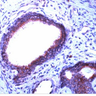 PDGFRB / PDGFR Beta Antibody - Human prostate stained with Anti-PDGFR beta