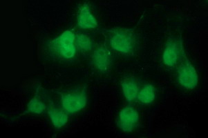 PDGFRB / PDGFR Beta Antibody - Anti-PDGFRB mouse monoclonal antibody immunofluorescent staining of COS7 cells transiently transfected by pCMV6-ENTRY PDGFRB.
