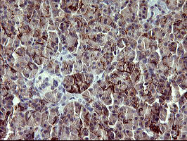 PDGFRB / PDGFR Beta Antibody - IHC of paraffin-embedded Human pancreas tissue using anti-PDGFRB mouse monoclonal antibody. (Heat-induced epitope retrieval by 10mM citric buffer, pH6.0, 120°C for 3min).
