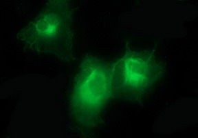 PDGFRB / PDGFR Beta Antibody - Anti-PDGFRB mouse monoclonal antibody immunofluorescent staining of COS7 cells transiently transfected by pCMV6-ENTRY PDGFRB.