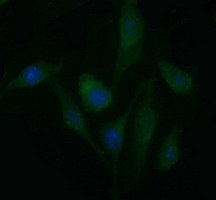 PDGFRB / PDGFR Beta Antibody - Immunofluorescent staining of HeLa cells using anti-PDGFRB mouse monoclonal antibody.