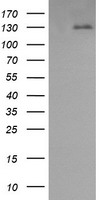 PDGFRB / PDGFR Beta Antibody - HEK293T cells were transfected with the pCMV6-ENTRY control (Left lane) or pCMV6-ENTRY PDGFRB (Right lane) cDNA for 48 hrs and lysed. Equivalent amounts of cell lysates (5 ug per lane) were separated by SDS-PAGE and immunoblotted with anti-PDGFRB.