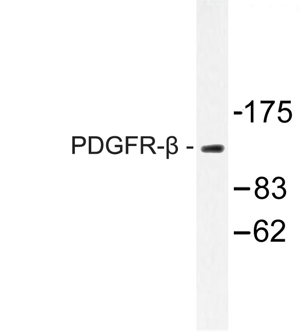 PDGFRB / PDGFR Beta Antibody - Western blot of PDGFR- (G1017) pAb in extracts from LOVO cells.