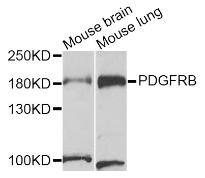 PDGFRB / PDGFR Beta Antibody - Western blot analysis of extracts of various cell lines.