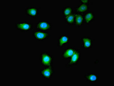 PDGFRB / PDGFR Beta Antibody - Immunofluorescent analysis of A549 cells using PDGFRB Antibody at dilution of 1:100 and Alexa Fluor 488-congugated AffiniPure Goat Anti-Rabbit IgG(H+L)