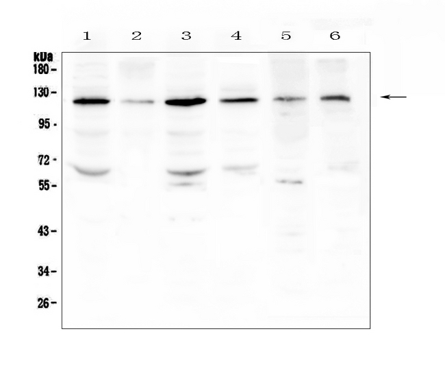 PDGFRB / PDGFR Beta Antibody - Western blot analysis of PDGFRB using anti-PDGFRB antibody. Electrophoresis was performed on a 5-20% SDS-PAGE gel at 70V (Stacking gel) / 90V (Resolving gel) for 2-3 hours. The sample well of each lane was loaded with 50ug of sample under reducing conditions. Lane 1: human Hela whole cell lysates,Lane 2: human HepG2 whole cell lysates,Lane 3: human SGC-7901 whole cell lysates,Lane 4: human K562 whole cell lysates,Lane 5: rat testis tissue lysates, Lane 6: mouse testis tissue lysates. After Electrophoresis, proteins were transferred to a Nitrocellulose membrane at 150mA for 50-90 minutes. Blocked the membrane with 5% Non-fat Milk/ TBS for 1.5 hour at RT. The membrane was incubated with rabbit anti-PDGFRB antigen affinity purified polyclonal antibody at 0.5 ?g/mL overnight at 4?C, then washed with TBS-0.1% Tween 3 times with 5 minutes each and probed with a goat anti-rabbit IgG-HRP secondary antibody at a dilution of 1:10000 for 1.5 hour at RT. The signal is developed using an Enhanced Chemiluminescent detection (ECL) kit with Tanon 5200 system. A specific band was detected for PDGFRB at approximately 120KD. The expected band size for PDGFRB is at 124KD.