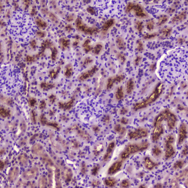 PDGFRB / PDGFR Beta Antibody - IHC analysis of PDGFRB using anti-PDGFRB antibody. PDGFRB was detected in paraffin-embedded section of rat kidney tissue . Heat mediated antigen retrieval was performed in citrate buffer (pH6, epitope retrieval solution) for 20 mins. The tissue section was blocked with 10% goat serum. The tissue section was then incubated with 2?g/ml rabbit anti-PDGFRB Antibody overnight at 4?C. Biotinylated goat anti-rabbit IgG was used as secondary antibody and incubated for 30 minutes at 37?C. The tissue section was developed using Strepavidin-Biotin-Complex (SABC) with DAB as the chromogen.