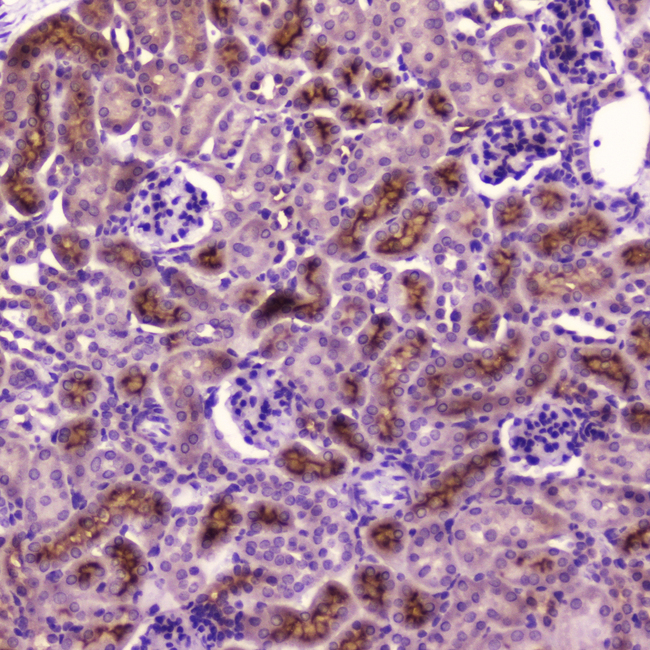 PDGFRB / PDGFR Beta Antibody - IHC analysis of PDGFRB using anti-PDGFRB antibody. PDGFRB was detected in paraffin-embedded section of mouse kidney tissue . Heat mediated antigen retrieval was performed in citrate buffer (pH6, epitope retrieval solution) for 20 mins. The tissue section was blocked with 10% goat serum. The tissue section was then incubated with 2µg/ml rabbit anti-PDGFRB Antibody overnight at 4°C. Biotinylated goat anti-rabbit IgG was used as secondary antibody and incubated for 30 minutes at 37°C. The tissue section was developed using Strepavidin-Biotin-Complex (SABC) with DAB as the chromogen.