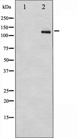 PDGFRB / PDGFR Beta Antibody - Western blot analysis of PDGFR beta expression in TNF-a treated Jurkat whole cells lysates. The lane on the left is treated with the antigen-specific peptide.
