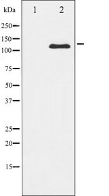 PDGFRB / PDGFR Beta Antibody - Western blot analysis of PDGFRb expression in HepG2 whole cells lysates. The lane on the left is treated with the antigen-specific peptide.