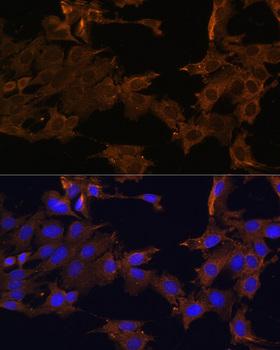 PDGFRB / PDGFR Beta Antibody - Immunofluorescence analysis of C6 cells using PDGFR beta Polyclonal Antibody at dilution of 1:100.Blue: DAPI for nuclear staining.