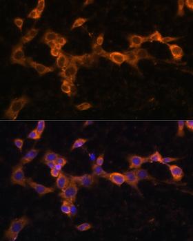 PDGFRB / PDGFR Beta Antibody - Immunofluorescence analysis of NIH/3T3 cells using PDGFR beta Polyclonal Antibody at dilution of 1:100.Blue: DAPI for nuclear staining.