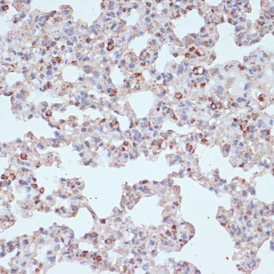 PDGFRB / PDGFR Beta Antibody - Immunohistochemistry of paraffin-embedded Rat lung using PDGFR beta Polyclonal Antibody at dilution of 1:100 (40x lens).