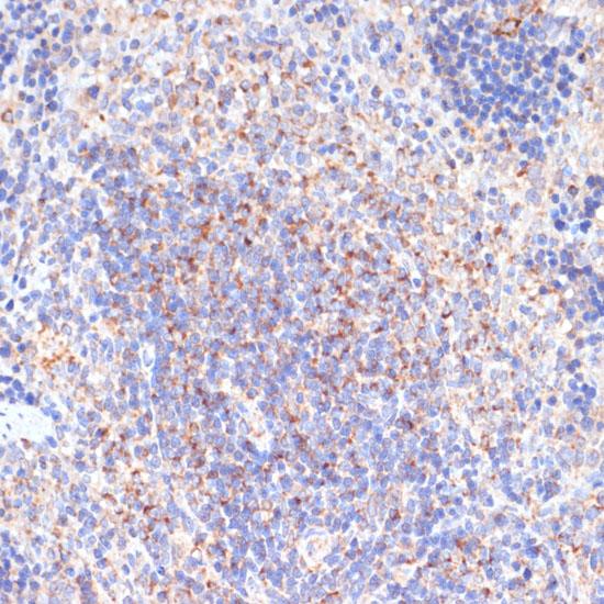 PDGFRB / PDGFR Beta Antibody - Immunohistochemistry of paraffin-embedded Rat spleen using PDGFR beta Polyclonal Antibody at dilution of 1:100 (40x lens).