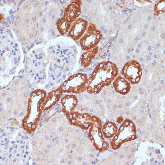 PDGFRB / PDGFR Beta Antibody - Immunohistochemistry of paraffin-embedded Rat kidney using PDGFR beta Polyclonal Antibody at dilution of 1:100 (40x lens).