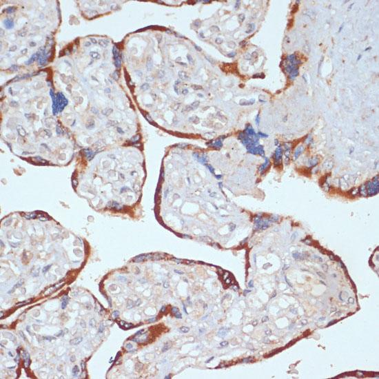 PDGFRB / PDGFR Beta Antibody - Immunohistochemistry of paraffin-embedded Human placenta using PDGFR beta Polyclonal Antibody at dilution of 1:100 (40x lens).