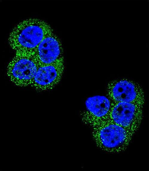 PDGFRB / PDGFR Beta Antibody - Confocal immunofluorescence of PDGFRB Antibody with WiDr cell followed by Alexa Fluor 488-conjugated goat anti-rabbit lgG (green). DAPI was used to stain the cell nuclear (blue).
