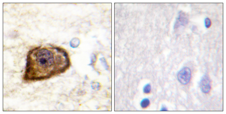 PDGFRB / PDGFR Beta Antibody - Immunohistochemistry analysis of paraffin-embedded human brain, using PDGFR beta (Phospho-Tyr1021) Antibody. The picture on the right is blocked with the phospho peptide.