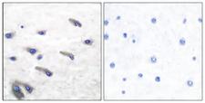 PDGFRB / PDGFR Beta Antibody - Immunohistochemistry analysis of paraffin-embedded human brain, using PDGF Receptor beta (Phospho-Tyr751) Antibody. The picture on the right is blocked with the phospho peptide.