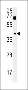 PDHA1 / PDH E1 Alpha Antibody - BDHA1 Antibody western blot of HepG2 cell line lysates (15 ug/lane). The BDHA1 antibody detected the BDHA1 protein (arrow).