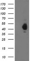 PDHA1 / PDH E1 Alpha Antibody - HEK293T cells were transfected with the pCMV6-ENTRY control (Left lane) or pCMV6-ENTRY PDHA1 (Right lane) cDNA for 48 hrs and lysed. Equivalent amounts of cell lysates (5 ug per lane) were separated by SDS-PAGE and immunoblotted with anti-PDHA1.