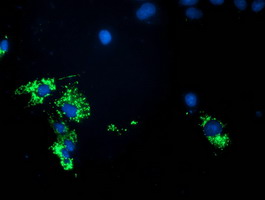 PDHA1 / PDH E1 Alpha Antibody - Anti-PDHA1 mouse monoclonal antibody immunofluorescent staining of COS7 cells transiently transfected by pCMV6-ENTRY PDHA1.